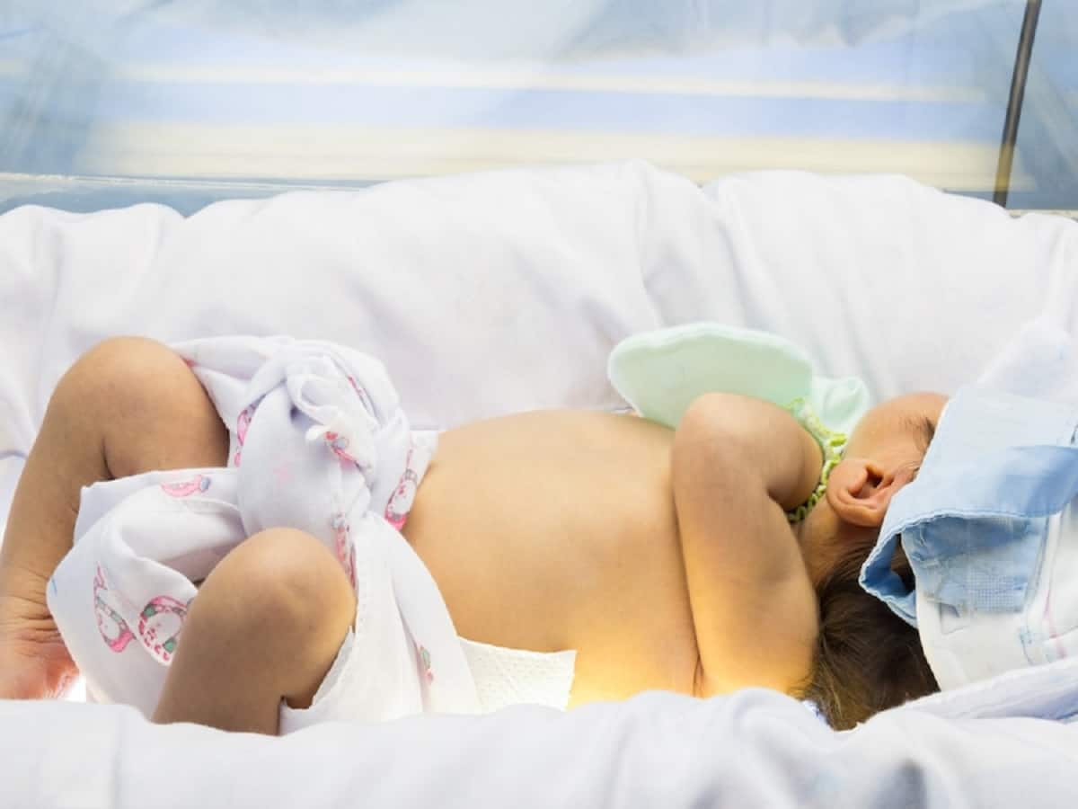 Why Are Newborns More Susceptible To Contracting Jaundice?